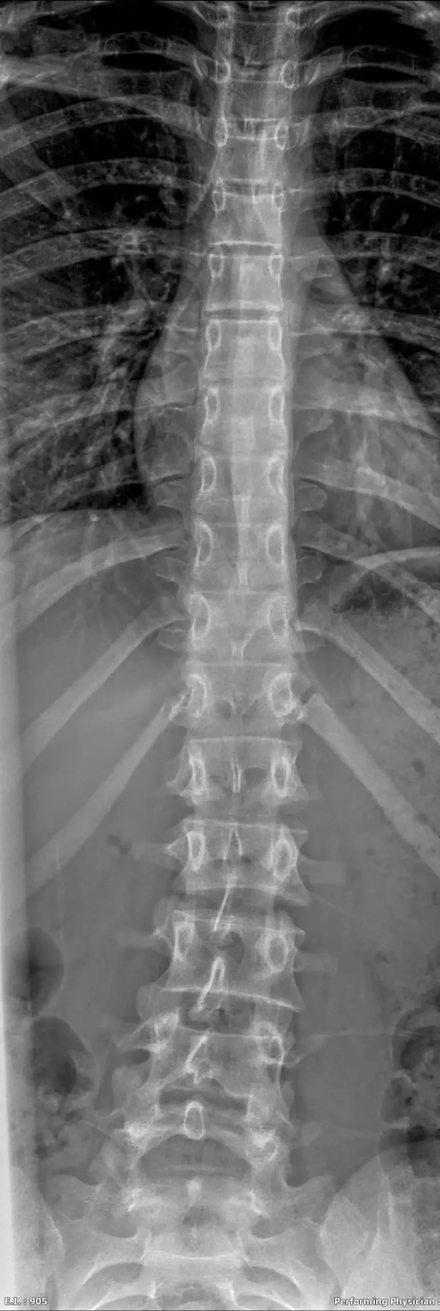 Full Spine-optimised