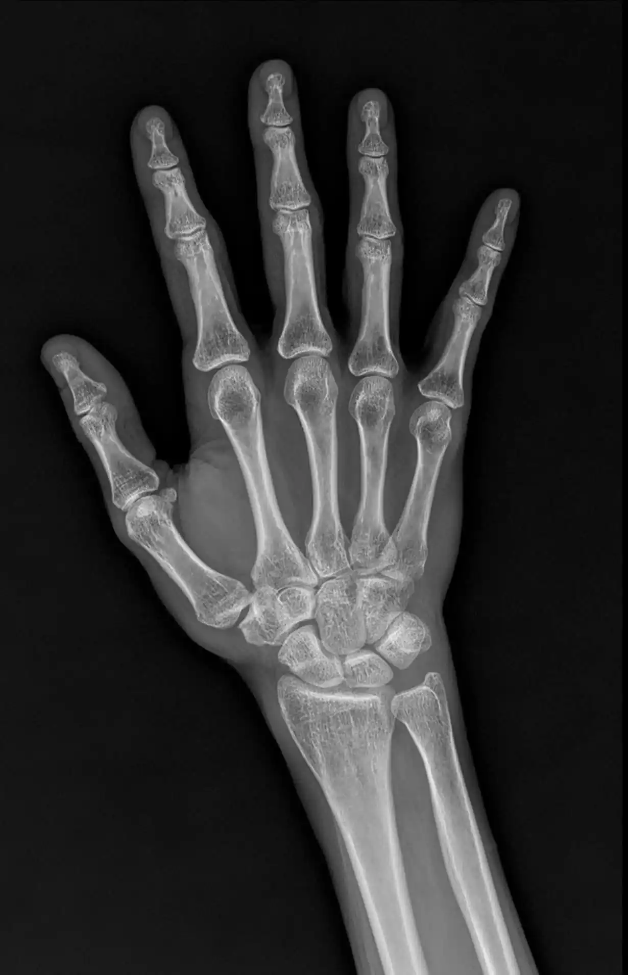 Hand-optimised