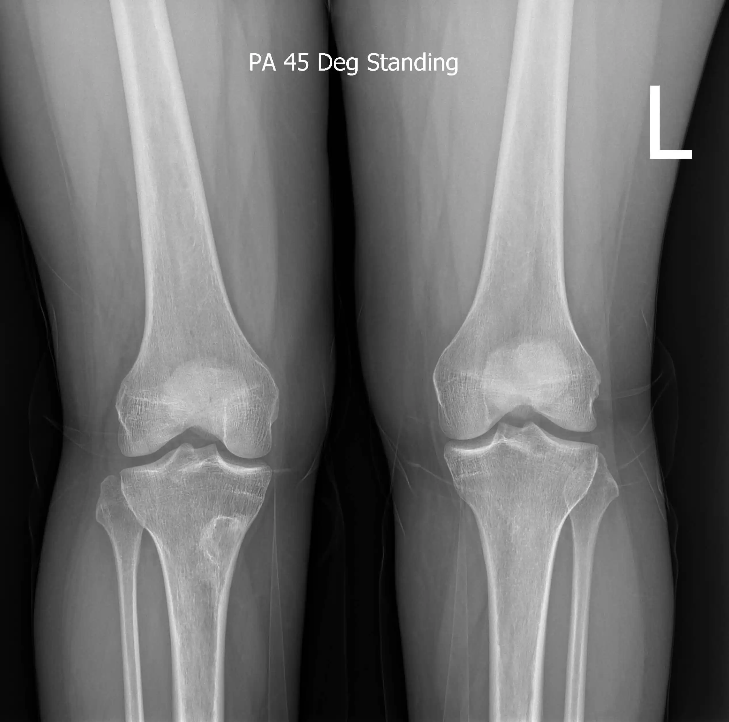Knee 00001-optimised